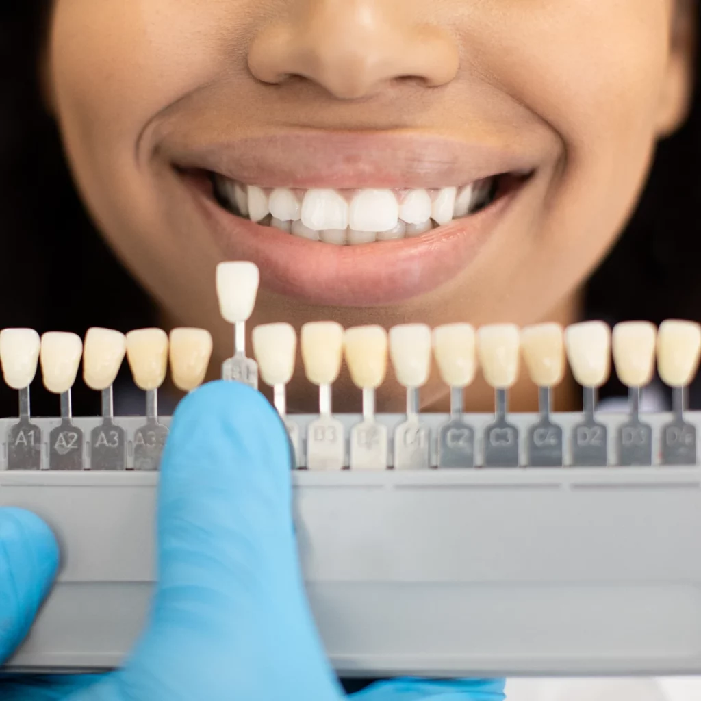 dental patient comparing different shades of porcelain veneers