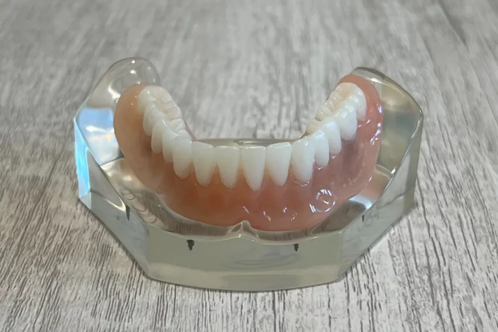 lower snap-in implant dentures